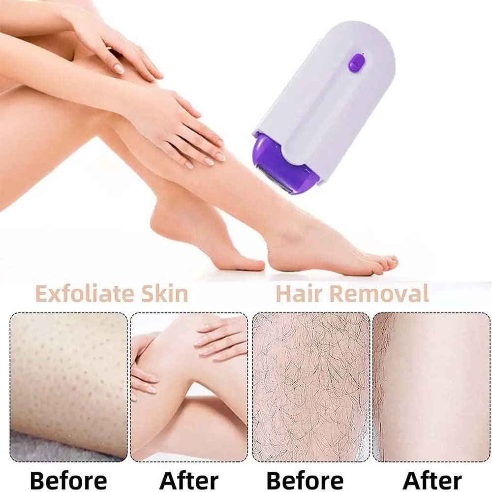 Removeo™ Hair Remover